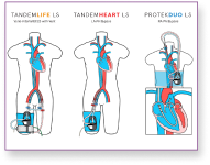 LifeSPARC Cannulation Guide